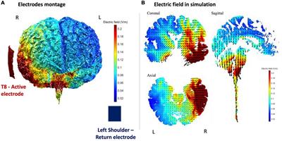 Effect of transcranialdirect current stimulation on the right brain temporal area on processing approach and avoidance attitudes with negation